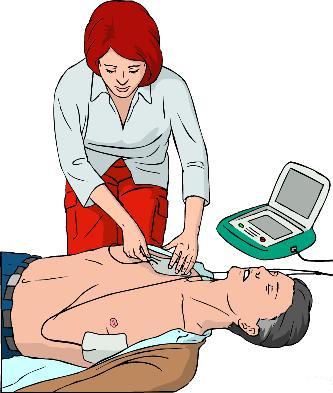 Pravilen položaj elektrod pri AED-ju